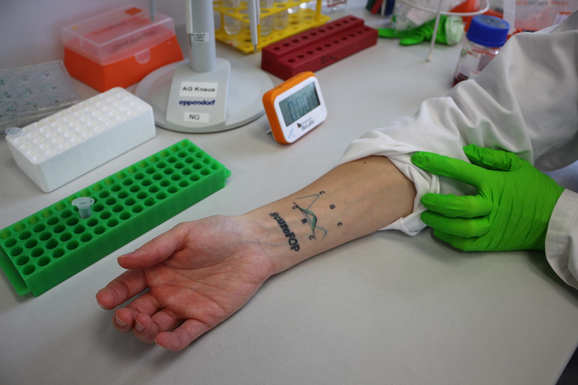 Nadine Großmann is committed to raise awareness for the disease. She had the hashtag #cureFOP tattoed on her forearm.