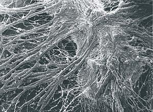 Rasterelektronenmikroskopische Aufnahme